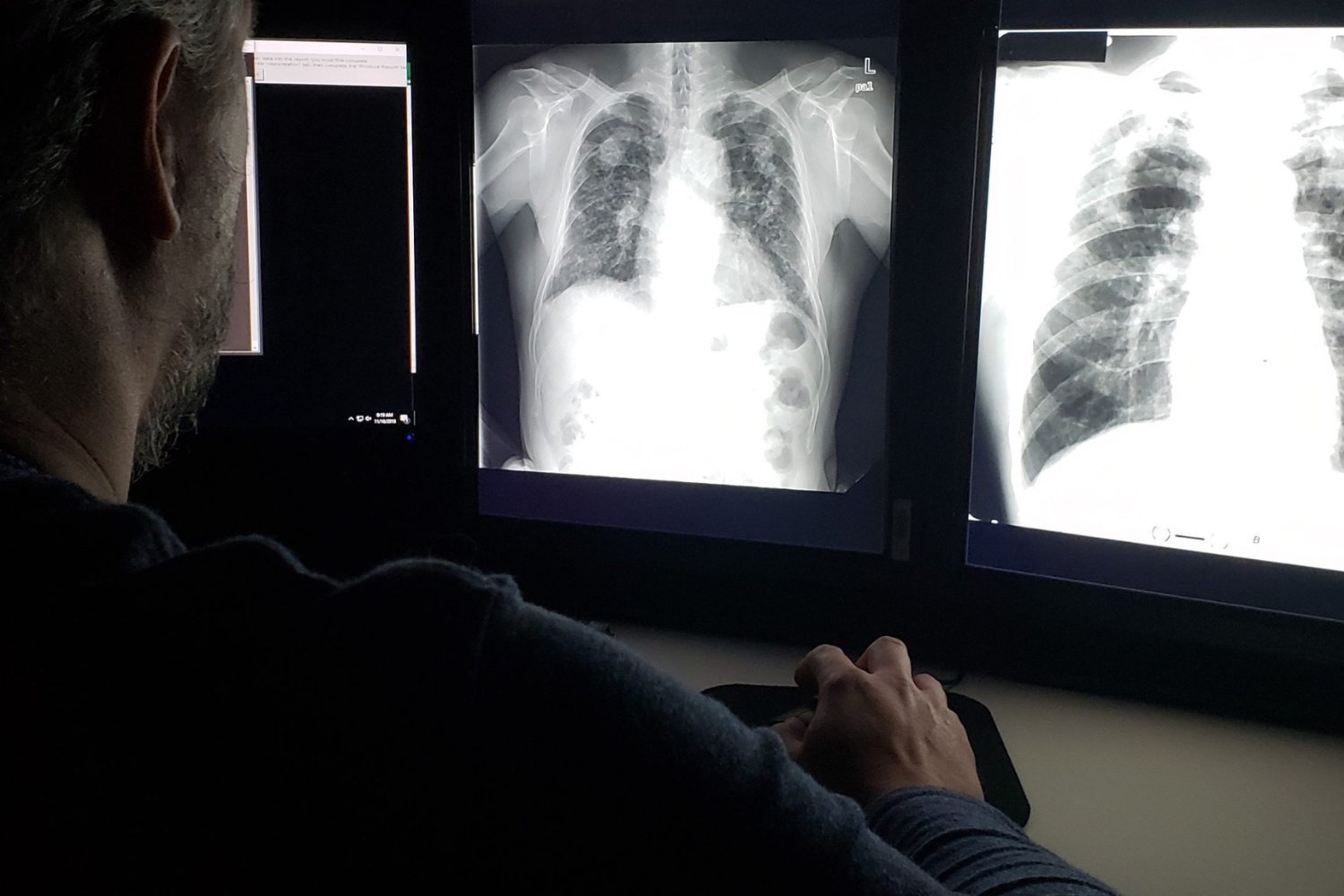 Lung Power Peaks in Our 20s—and It's a Steady Decline From There, Study Finds