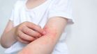 Study Says U.S. Babies Are Missing a Key Gut Microbe, Fueling Allergy Risk