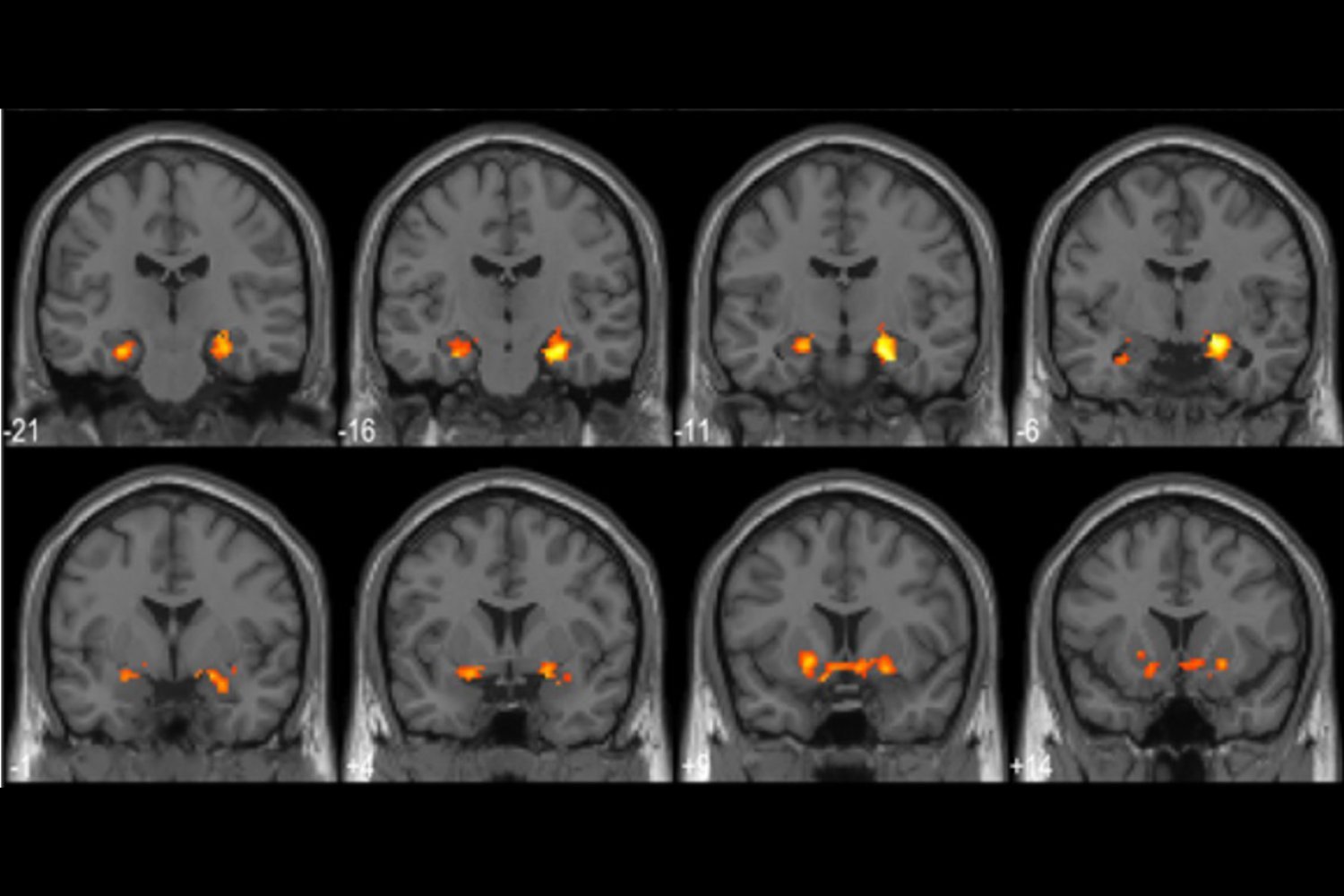 This Is What Your Brain Looks Like When You Solve a Problem