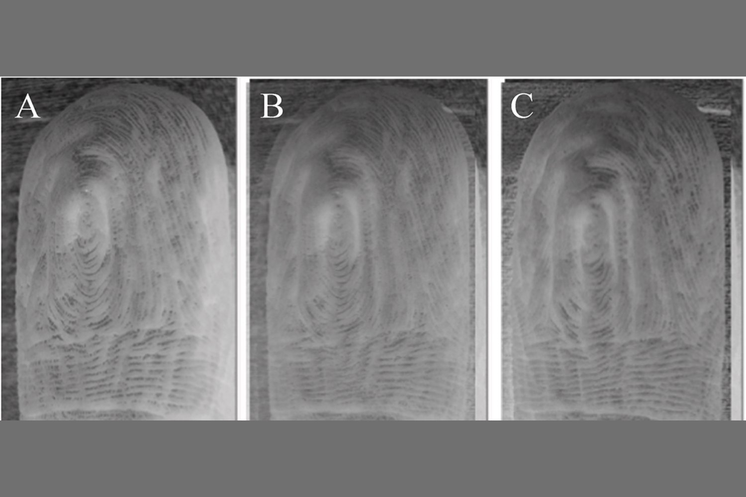 Your Pruney Fingers After After a Bath Always Wrinkle the Same Way, Study Reveals