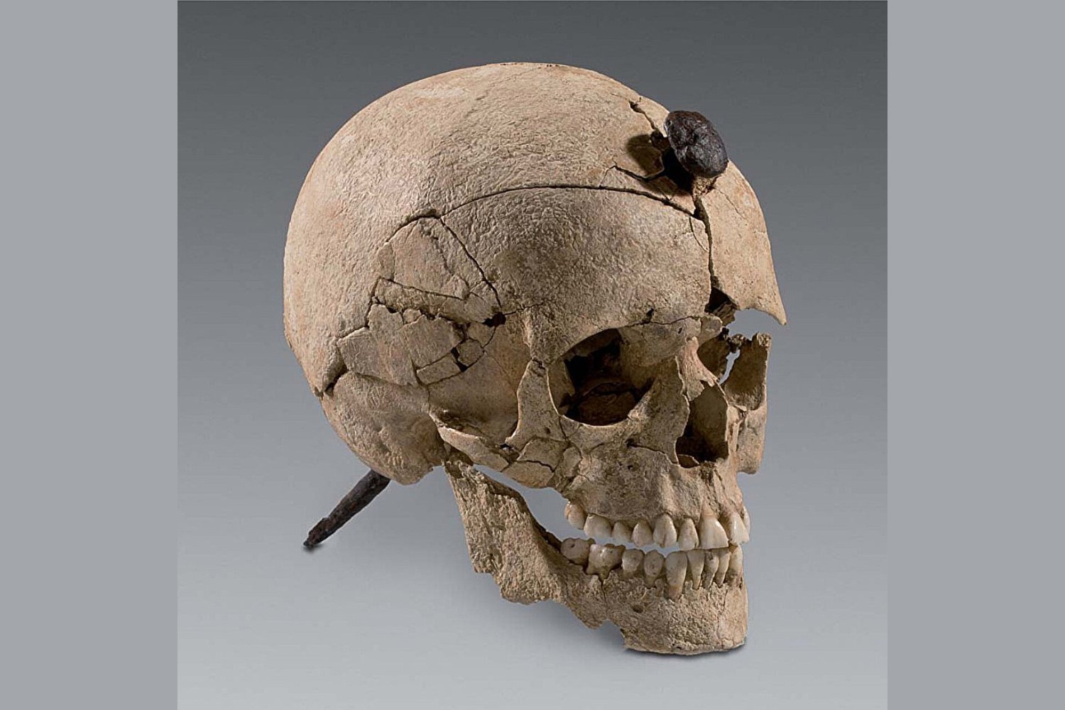 Severed Heads in Iron Age Iberia Weren’t Just War Trophies, New Research Suggests